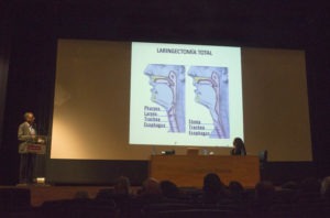 Laringectomía Total